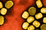 全球已有15个国家报告猴痘病例 谨防病毒传播